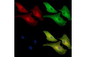ABIN7097091 and ABIN7101158 staining  cells by IF/ICC. (NCF1C anticorps)