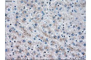 Image no. 2 for anti-Checkpoint Kinase 2 (CHEK2) antibody (ABIN1497497)