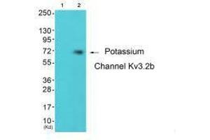 Western blot analysis of extracts from 293 cells (Lane 2), using Potassium Channel Kv3. (KCNC2 anticorps)