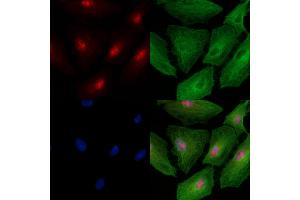 Phospho-NLRC4 (Ser533) Antibody staining A549 cells(heat shock treatment) by IF/ICC.