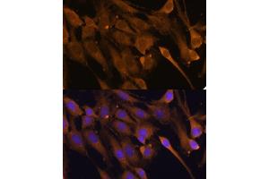 Immunofluorescence analysis of C6 cells using STUB1 Polyclonal Antibody (ABIN6129459, ABIN6148649, ABIN6148650 and ABIN6215447) at dilution of 1:100 (40x lens). (STUB1 anticorps  (AA 1-303))