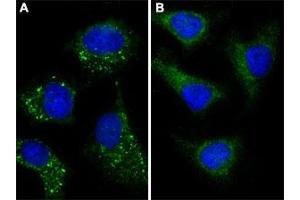 Immunofluorescent staining of Chloroquine (50 uM, 16h) treated (A) and untreated (B) HeLa cells with MAP1LC3A (Cleaved) polyclonal antibody  shows vesicles staining at 1: 25 dilution. (MAP1LC3A anticorps  (AA 89-120))