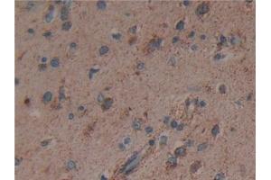 Detection of CS in Human Brain Tissue using Polyclonal Antibody to Citrate Synthase (CS)