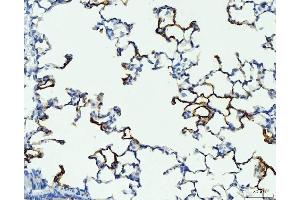 IHC analysis of RAGE/AGER using anti-RAGE/AGER antibody (ABIN7601722). (RAGE anticorps  (AA 43-404))