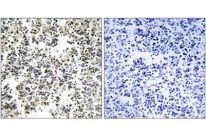 Immunohistochemistry analysis of paraffin-embedded human lymph node, using IGLL1 Antibody. (IGLL1 anticorps  (AA 161-210))