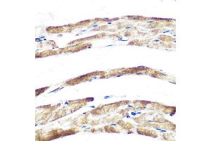 Immunohistochemistry of paraffin-embedded rat heart using Fbx32/FBOX32 Rabbit mAb (ABIN7267090) at dilution of 1:100 (40x lens).