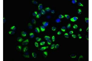 Immunofluorescence staining of Hela cells with ABIN7170299 at 1:166, counter-stained with DAPI. (SLCO2A1 anticorps  (AA 416-518))