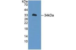 Detection of Recombinant XYLT2, Human using Polyclonal Antibody to Xylosyltransferase II (XYLT2) (XYLT2 anticorps  (AA 596-865))