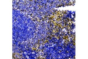 IHC analysis of ZEB2 using anti-ZEB2 antibody (ABIN3042325). (ZEB2 anticorps  (AA 1-200))