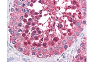 Anti-HSPA4L antibody IHC of human testis. (HSPA4L anticorps  (AA 825-839))
