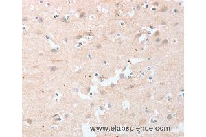 Immunohistochemistry of Human brain  using LY96 Polyclonal Antibody at dilution of 1:20 (LY96 anticorps)