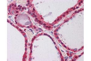 Anti-PPP2R1A antibody IHC of human thyroid.