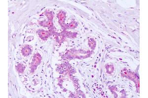 Anti-Syntenin antibody IHC of human breast. (SDCBP anticorps  (AA 6-19))