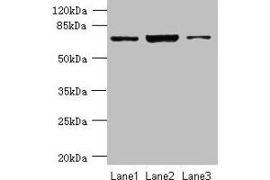 Western blot All lanes: CCDC116 antibody at 1. (CCDC116 anticorps  (AA 1-300))