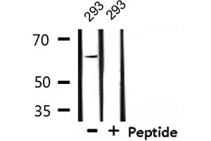 Western blot analysis of extracts from 293, using TGFR2 Antibody. (TGFBR2 anticorps  (Internal Region))