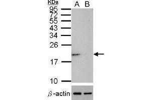 WB Image Western blot analysis of SOD1 (, upper panel) and beta-actin , lower panel)  Sample (30 ug of whole cell lysate)  A: HeLa mock control  B: HeLa transfected shSOD1 15% SDS PAGE  antibody diluted at 1:500 (SOD1 anticorps  (C-Term))