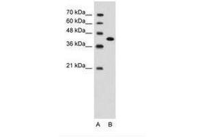 Image no. 2 for anti-Carcinoembryonic Antigen-Related Cell Adhesion Molecule 6 (CEACAM6) (AA 216-265) antibody (ABIN203400) (CEACAM6 anticorps  (AA 216-265))