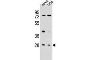 Western Blotting (WB) image for anti-Tetraspanin 26 (TSPAN26) antibody (ABIN2995796) (CD37 anticorps)