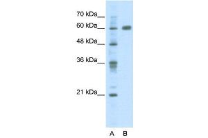 WB Suggested Anti-PDLIM5  Antibody Titration: 2. (PDLIM5 anticorps  (C-Term))