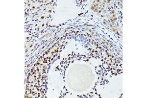 Immunohistochemistry of paraffin-embedded rat ovary using [KO Validated] CDK4 Rabbit mAb  at dilution of 1:100 (40x lens). (CDK4 anticorps)