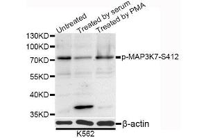 Western blot analysis of extracts of K-562 cells, using Phospho-MAP3K7-S412 antibody (ABIN5995645) at 1/1000 dilution. (MAP3K7 anticorps  (pSer439))
