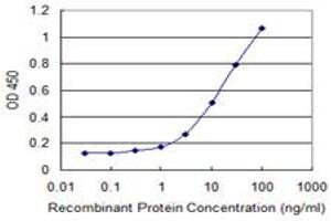 anti-Sushi Domain Containing 5 (SUSD5) (AA 284-383) antibody