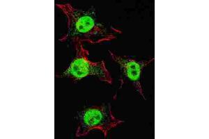 Immunofluorescence (IF) image for anti-Integrin, alpha 6 (ITGA6) antibody (ABIN3001611) (ITGA6 anticorps)