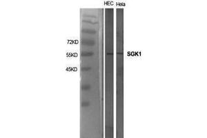 Western Blotting (WB) image for anti-serum/glucocorticoid Regulated Kinase 1 (SGK1) (Tyr1054), (Tyr1063) antibody (ABIN3186929)