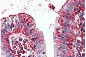 Anti-C8orf55 antibody  ABIN960747 IHC staining of human small intestine. (THEM6 anticorps  (Internal Region))