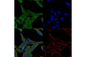 Immunofluorescence Analysis of HeLa cells labeling Fascin with Fascin-1 Mouse Monoclonal Antibody (FSCN1/417)-CF640 (Green).