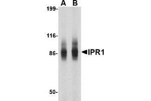 Western Blotting (WB) image for anti-SP110 Nuclear Body Protein (SP110) (N-Term) antibody (ABIN1031418) (SP110 anticorps  (N-Term))