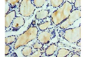 Immunohistochemistry of paraffin-embedded human thyroid tissue using ABIN7151875 at dilution of 1:100