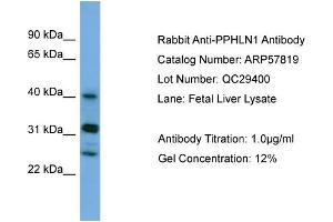WB Suggested Anti-PPHLN1  Antibody Titration: 0. (PPHLN1 anticorps  (N-Term))