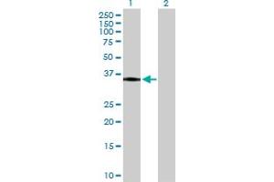 Western Blot analysis of HLA-DRA expression in transfected 293T cell line by HLA-DRA MaxPab polyclonal antibody. (HLA-DRA anticorps  (AA 1-254))