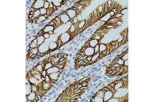 Immunohistochemistry of paraffin-embedded human colon using CLDN3 antibody (ABIN3017039, ABIN3017040, ABIN3017041, ABIN1679261 and ABIN6219930) (40x lens). (Claudin 3 anticorps)