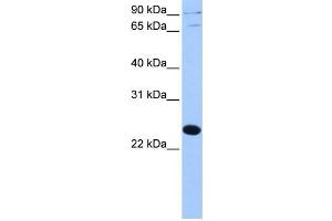 Western Blotting (WB) image for anti-Thyroid Hormone Receptor Associated Protein 3 Pseudogene 1 (THRAP3P1) antibody (ABIN2459455) (THRAP3P1 anticorps)