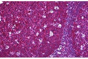 Human Tonsil: Formalin-Fixed, Paraffin-Embedded (FFPE) (FLIP anticorps  (AA 178-277))