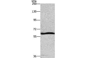 Western blot analysis of Hela cell, using DCP1A Polyclonal Antibody at dilution of 1:1100 (DCP1A anticorps)