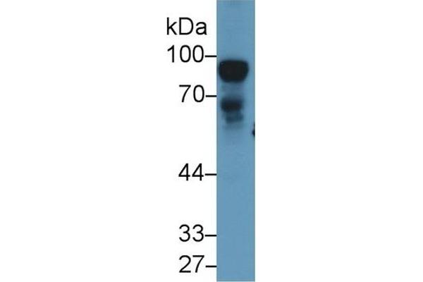 NEXN antibody  (AA 214-455)