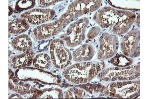 Image no. 4 for anti-Dynamin 1-Like (DNM1L) antibody (ABIN1497870)