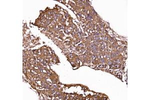 IHC analysis of GPR54/KISS1R using anti-GPR54/KISS1R antibody (ABIN7602153). (KISS1R anticorps  (AA 60-373))