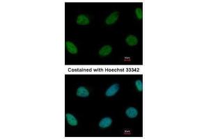 anti-Zinc Finger E-Box Binding Homeobox 1 (ZEB1) antibody