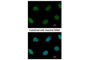 ICC/IF Image Immunofluorescence analysis of paraformaldehyde-fixed HeLa, using ZEB1, antibody at 1:1000 dilution. (ZEB1 anticorps)