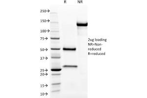 SDS-PAGE Analysis Purified Aurora B Mouse Monoclonal Antibody (AURKB/1593).