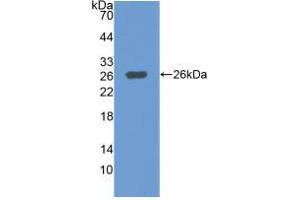 Western blot analysis of recombinant Human MAP3K1. (MAP3K1 anticorps  (AA 1307-1509))