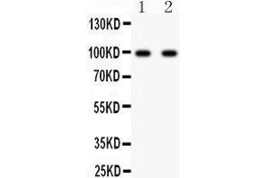 Anti- GRIA2 antibody, Western blotting All lanes: Anti GRIA2  at 0. (GRIA2 anticorps  (AA 25-360))
