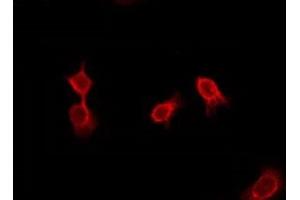 ABIN6276012 staining Hela by IF/ICC. (GPR144 anticorps)