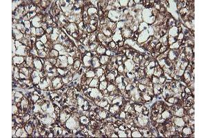 Immunohistochemistry (IHC) image for anti-Acetyl-CoA Acyltransferase 2 (ACAA2) antibody (ABIN1495723)