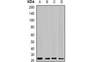 Western blot analysis of GTL3 expression in SKOV3 (A), HepG2 (B), mouse liver (C), rat lung (D) whole cell lysates. (C16orf80 anticorps)