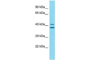 Host:  Rabbit  Target Name:  ZNF414  Sample Type:  Stomach Tumor lysates  Antibody Dilution:  1. (ZNF414 anticorps  (C-Term))